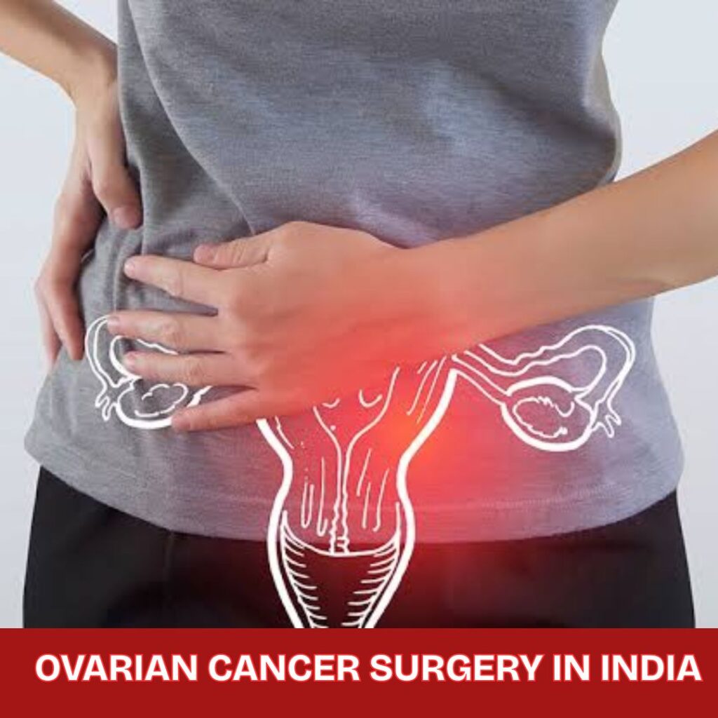 Ovarian Cancer Surgery in India.jpg