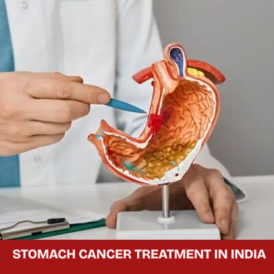 Stomach Cancer Treatment in India.jpg