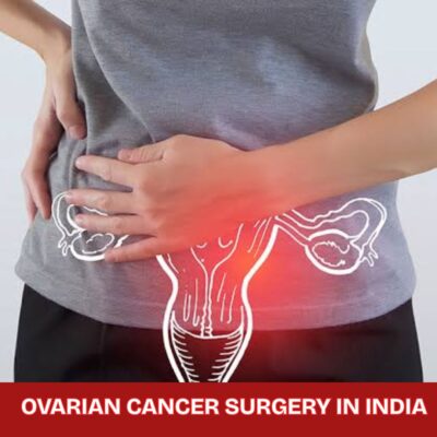 Ovarian Cancer Surgery in India.jpg